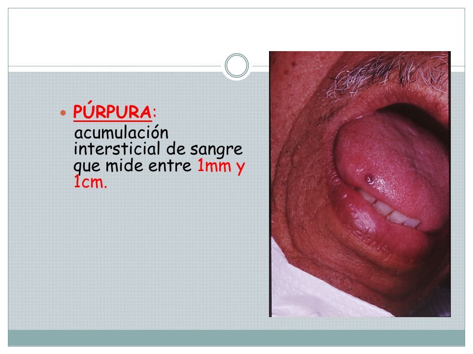 Las manchas de pigmento después del peeling no pasan